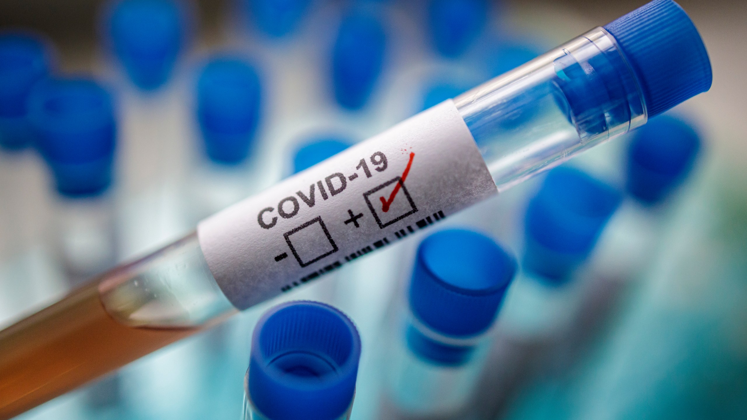 image of a test tube with covid-19 marked positive