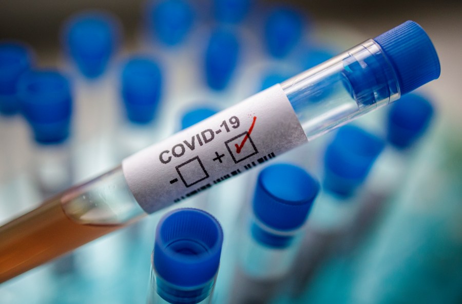 image of a test tube with covid-19 marked positive