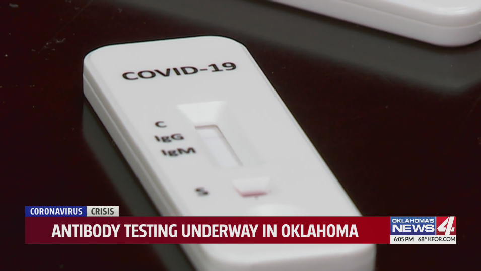 CoVId-19 antibody test