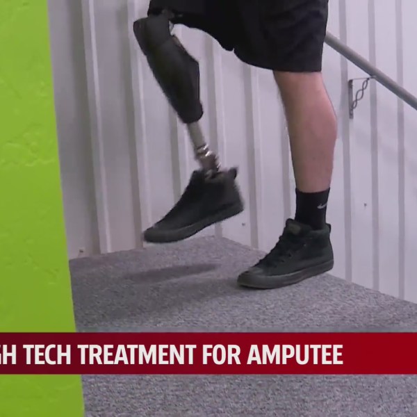 man tests out prosthetic by climbing stairs